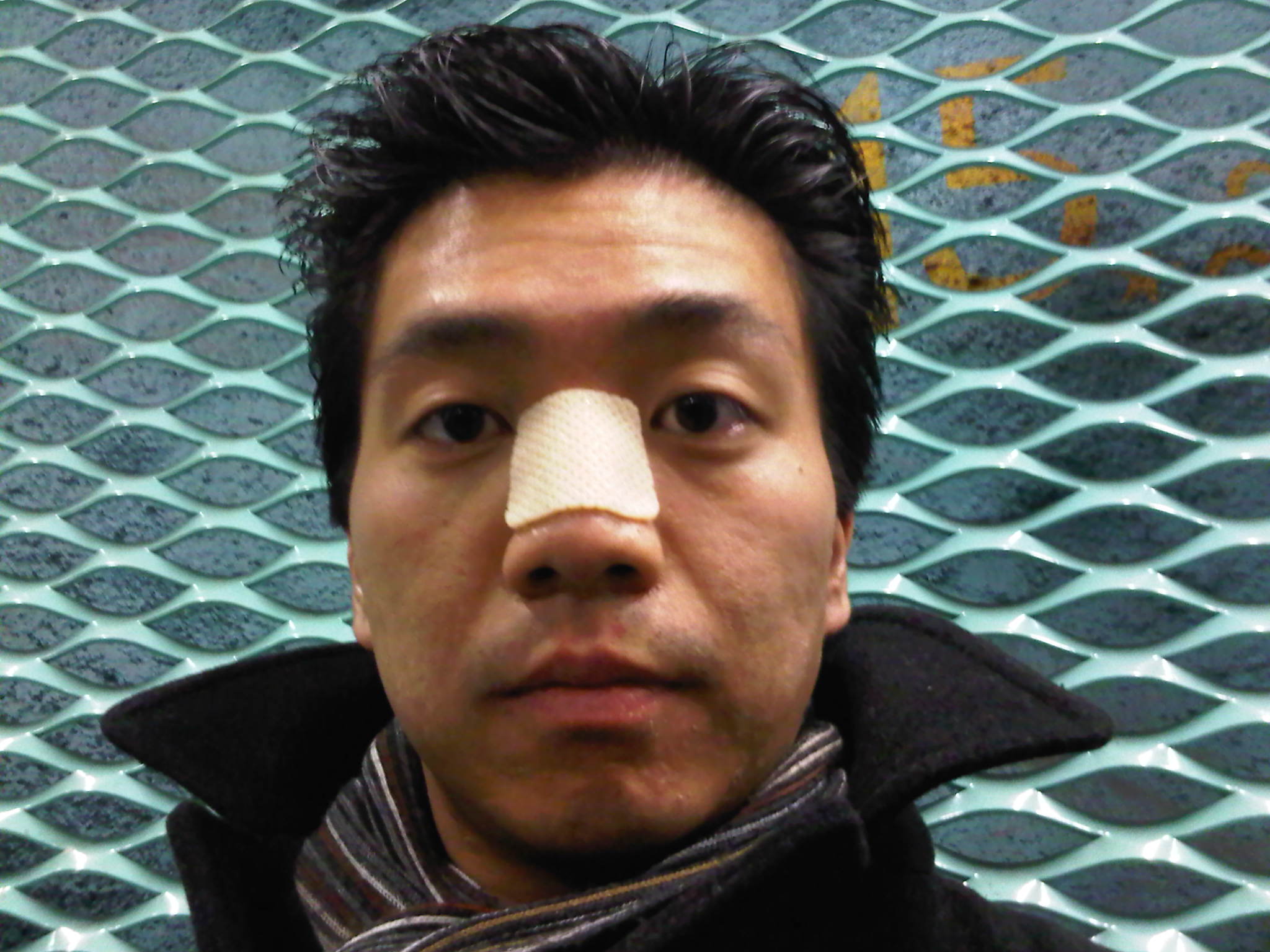 A broken nose and 350 SEK poorer | trulyswedish